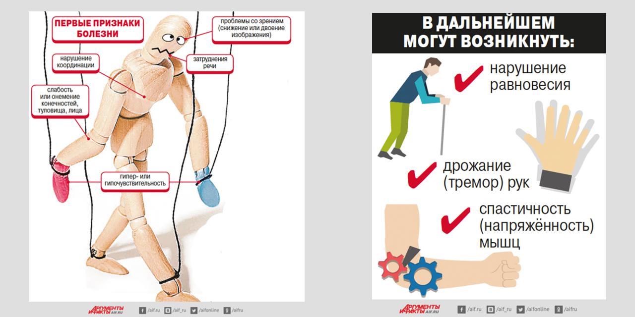 22.07.2021 Болезнь молодых. Как заподозрить рассеянный склероз на ранней стадии?
