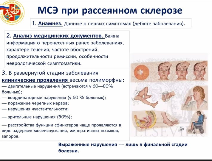 Шкала инвалидности при рассеянном склерозе